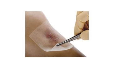 Sterile gauzes
